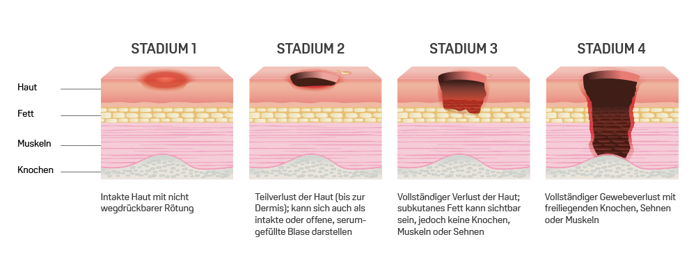 klassifikation wundstadium