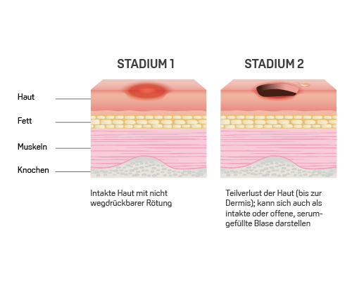 klassifikation wundstadium